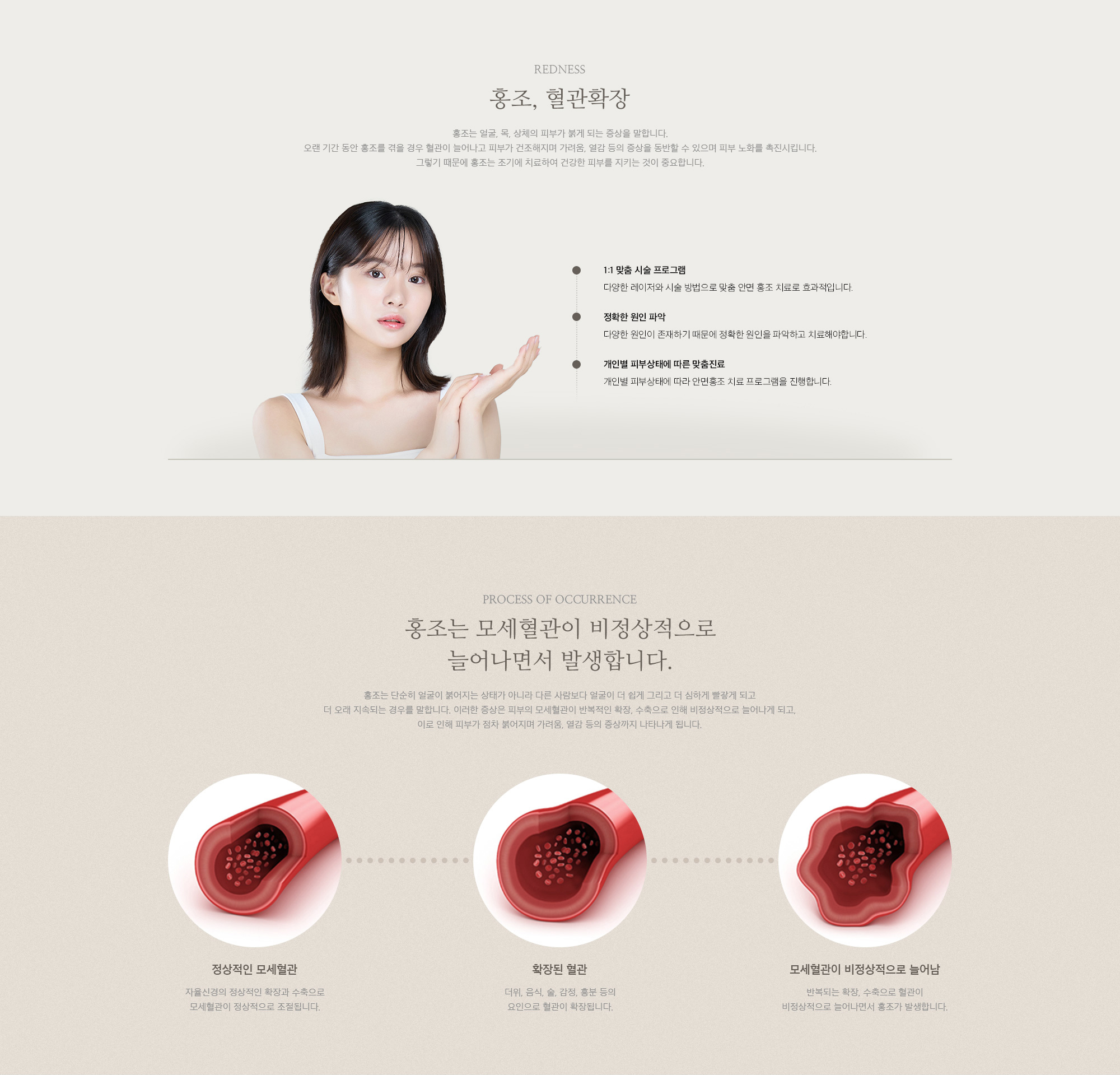 홍조, 혈관확장
